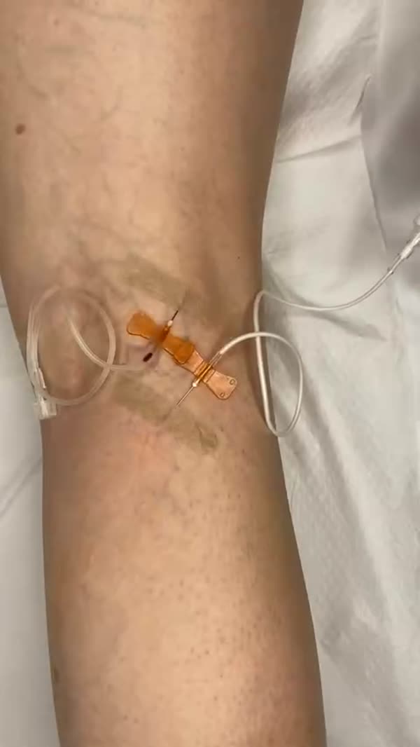Видео от процедура 3
